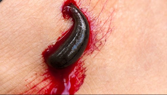 leech bite during trekking