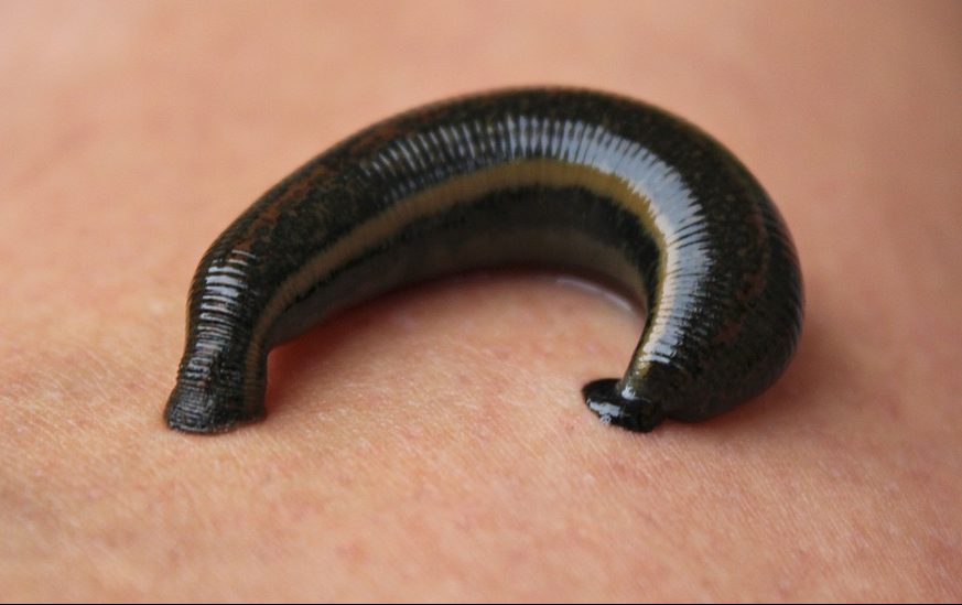 leech on body