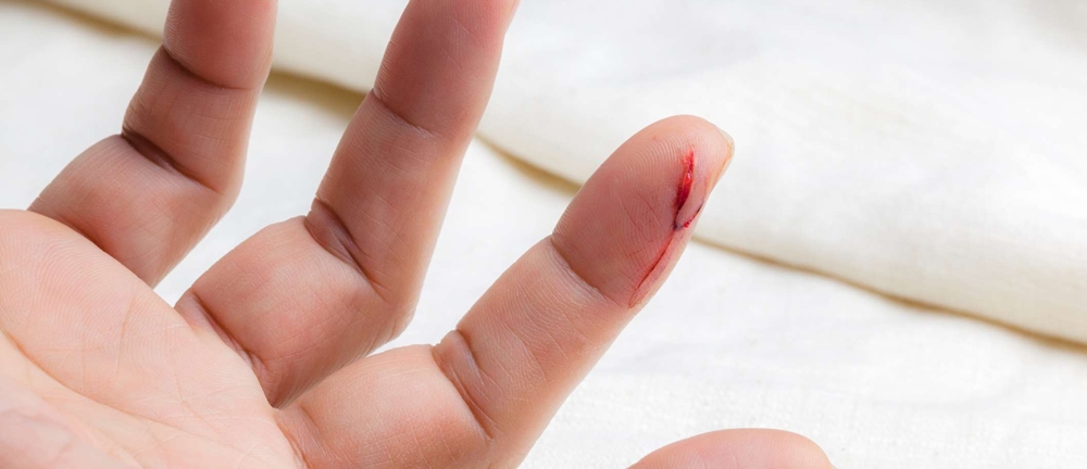 A bleeding cut on a finger